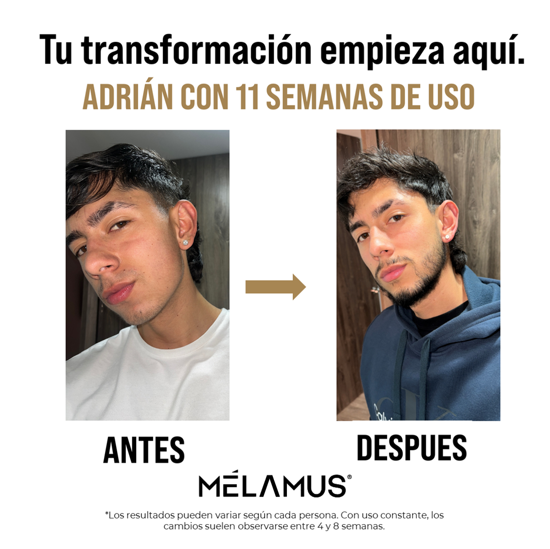 Bálsamo Mélamus - Minoxidil 20%