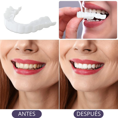 😱OFERTA EXCLUSIVA 2X1😱 Carillas Dentales Adaptables - Transforma tu Sonrisa