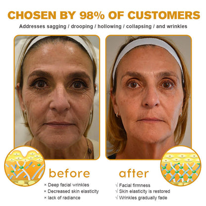 Crema para eliminar arrugas con veneno de abeja y botox